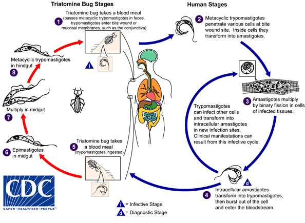 Trypanosoma cruzi Chagas disease Santa Barbara